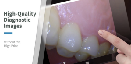 Dental intra-oral camera