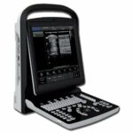 Portable Ultrasound Chison ECO1