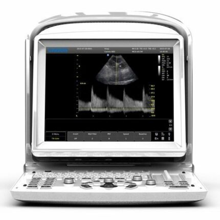 Chison Eco3 Expert- Ultrasound Device