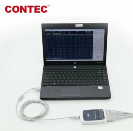CONTEC 8000G 12 Lead ECG workstation mini size EKG machine connected with computer