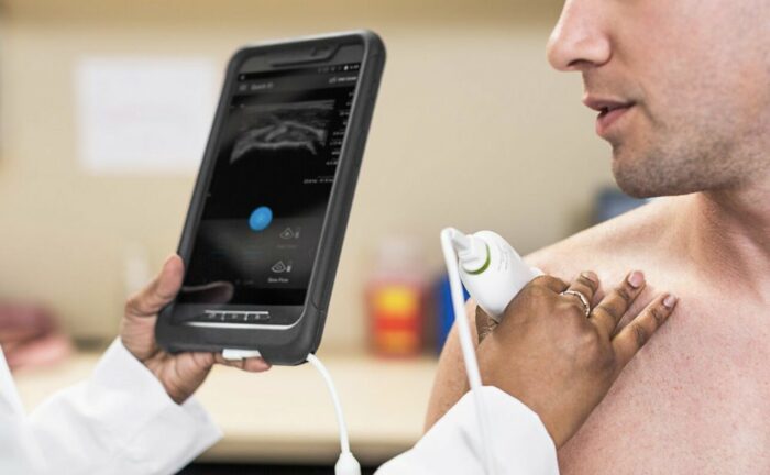 Philips Lumify Ultrasound System C5-2 Convex