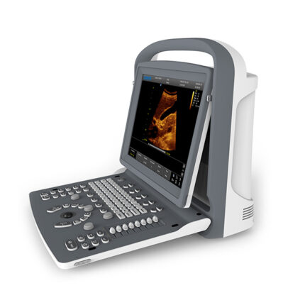 CHISON EC02 Portable Ultrasound with Convex Probe
