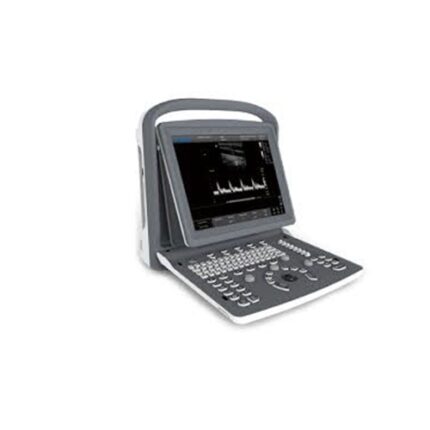 CHISON EC02 Portable Ultrasound with Convex Probe