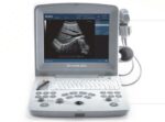 Ultrasound Portable EDAN DUS-60